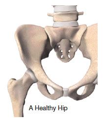 A Healthy Hip